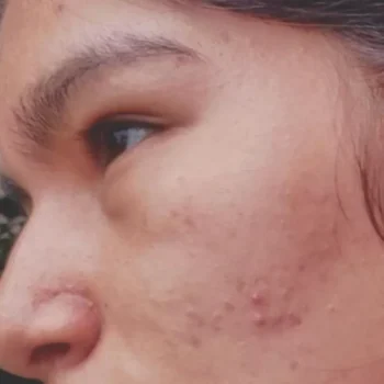 organic-serum-caso-3 organic-serum-caso-3